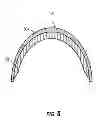 Fig. 07 - AMPUTATION RESIDUUM DEVICE AND METHOD OF USING THE SAME