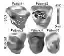Fig. 01 - System and method for personalized cardiac arrhythmia risk assessment by simulating arrhythmia inducibility