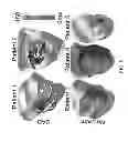 Fig. 06 - System and method for personalized cardiac arrhythmia risk assessment by simulating arrhythmia inducibility