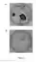 Fig. 04 - Plants having increased tolerance to herbicides