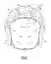 Fig. 06 - Protective helmet