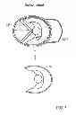 Fig. 06 - BALL CAP SHIELD