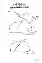 Fig. 07 - BALL CAP SHIELD