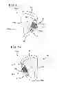 Fig. 02 - Caribiner