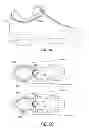 Fig. 10 - Devices and methods for adjusting the fit of footwear