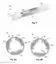 Fig. 05 - Methods of making leads with retention features for segmented electrodes