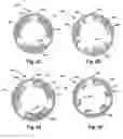 Fig. 06 - Methods of making leads with retention features for segmented electrodes