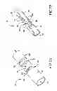 Fig. 08 - Assembly of passive cardiac electrical lead