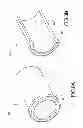 Fig. 09 - Assembly of passive cardiac electrical lead