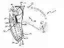 Fig. 01 - Pocket safety cutter