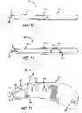 Fig. 07 - Pocket safety cutter