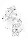 Fig. 11 - Torque converter stator structure