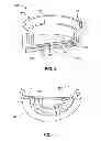 Fig. 03 - Micro-mixer nozzle