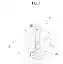 Fig. 04 - Variable compression ratio apparatus