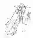 Fig. 20 - Dose counter with lockout mechanism