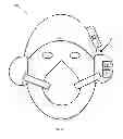 Fig. 03 - Automated Hypoxia Recovery System