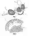 Fig. 02 - Nostril Filtration Assembly