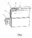 Fig. 04 - Ventilator mask with a filler and method of production