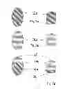 Fig. 07 - Ventilator mask with a filler and method of production
