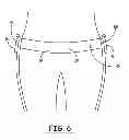 Fig. 07 - Portable system for assisting body movement