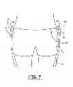 Fig. 08 - Portable system for assisting body movement