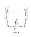 Fig. 16 - Portable system for assisting body movement