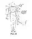 Fig. 37 - Portable system for assisting body movement