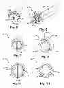 Fig. 03 - Pop-up nozzle, cleaning device and method of operation