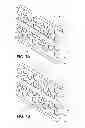 Fig. 07 - Methods of flow baffle installation