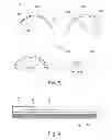 Fig. 05 - Unbonded flexible pipe and pipe system