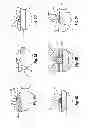 Fig. 06 - Pipeline reinforcement assembly and method