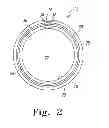 Fig. 03 - Acetabular cup having a wireless communication device