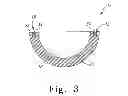 Fig. 04 - Acetabular cup having a wireless communication device