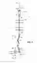 Fig. 06 - Antigalloping Device