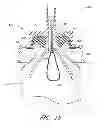 Fig. 22 - Adaptors for removing medicinal fluids from a container
