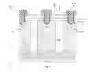 Fig. 04 - Charged balanced devices with shielded gate trench