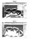 Fig. 07 - Method for manufacturing transparent braces