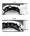 Fig. 13 - Method for manufacturing transparent braces