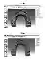 Fig. 17 - Method for manufacturing transparent braces