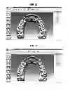 Fig. 19 - Method for manufacturing transparent braces