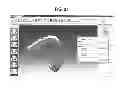 Fig. 23 - Method for manufacturing transparent braces