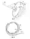 Fig. 08 - TOROIDAL MOTOR DESIGN HAVING BACK EMF REDUCTION