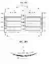 Fig. 08 - Phased array RF coil for magnetic resonance imaging