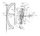 Fig. 01 - Method for optimized prediction of the postoperative anatomical position of an intraocular lens implanted in a pseudopakic eye