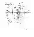 Fig. 02 - Method for optimized prediction of the postoperative anatomical position of an intraocular lens implanted in a pseudopakic eye