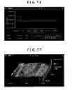 Fig. 44 - Image display device