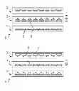 Fig. 05 - Tension transients suppression during acceleration and/or deceleration for storage tape drive