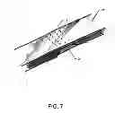 Fig. 08 - Portable electronic device body having laser perforation apertures and associated fabrication method