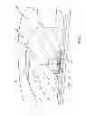 Fig. 02 - Lens with inner-cavity surface shaped for controlled light refraction