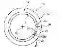 Fig. 01 - GENERATION OF MULTIPLE ENERGY X-RAY RADIATION